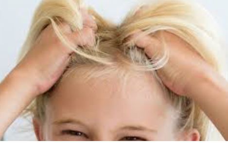 Headlice